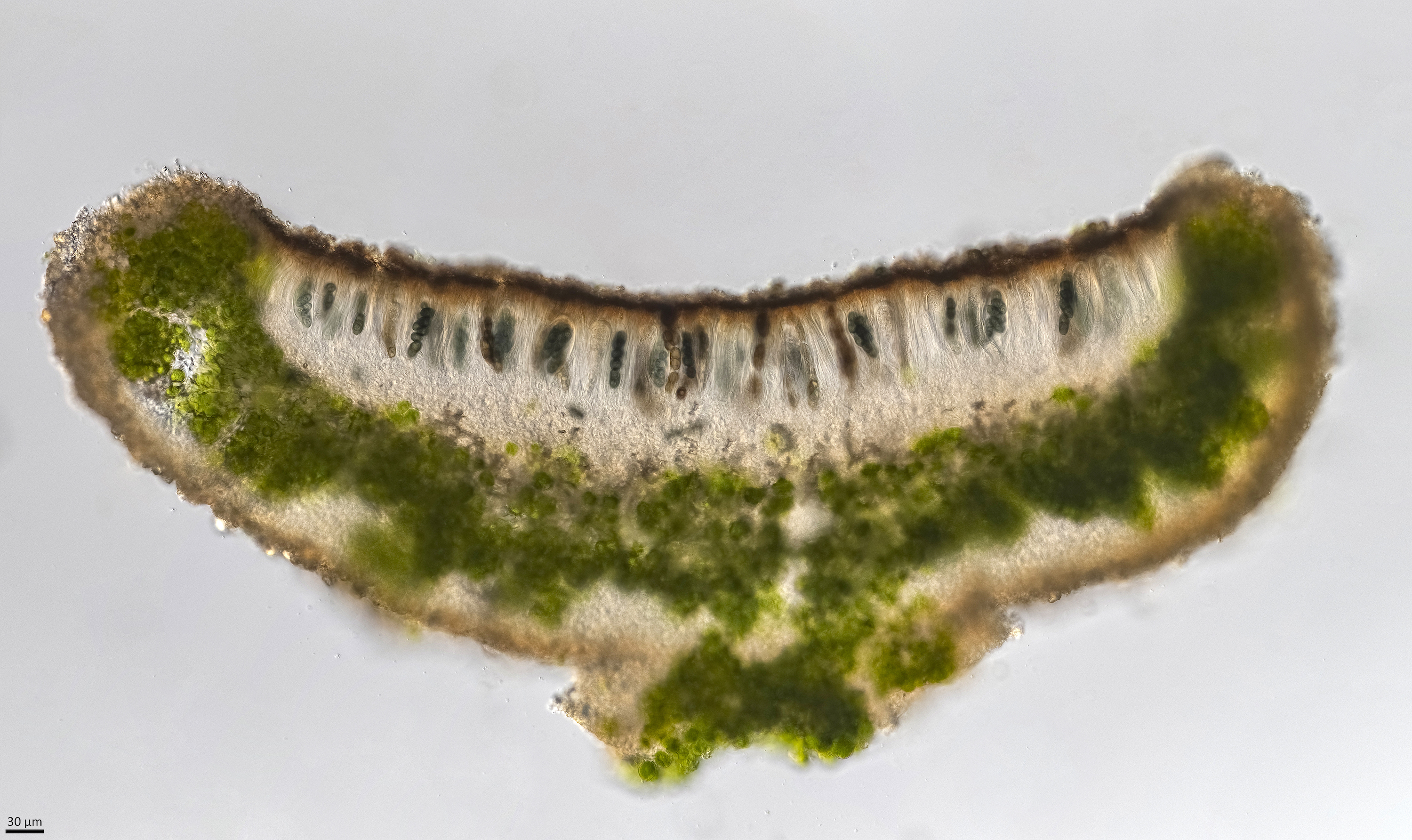 physcia_aipolia_web.jpg